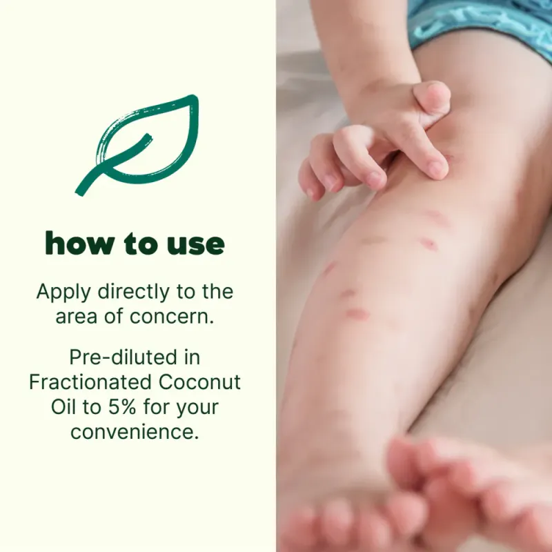 Itch Away roll-on - eterisk oljeblading 10ml / Plant Therapy